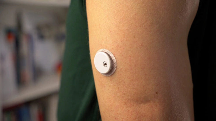 LinX CGM vs Métodos Tradicionales: Por Qué el Monitoreo Continuo Es la Nueva Era