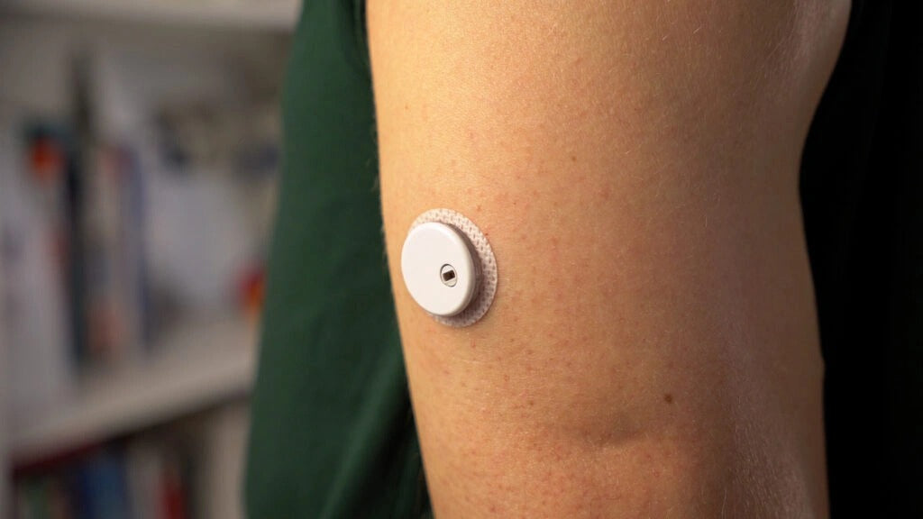 LinX CGM vs Métodos Tradicionales: Por Qué el Monitoreo Continuo Es la Nueva Era